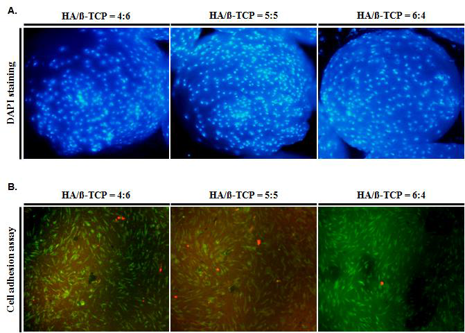 Comparison of cell attachment on the bone grafting materials synthesized as the defined mixing ratio of HA and β-TCP synthesized from Abalone shell