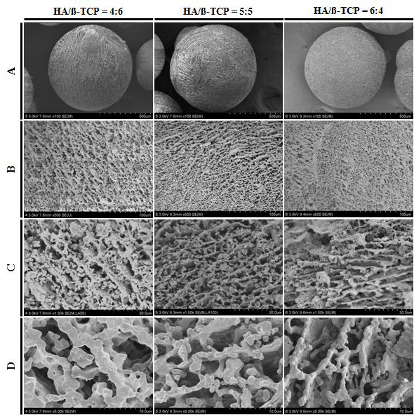 The electromicroscopic evaluation of particle size, surface, roughness, and pore size on each bone grafting materials synthesized as the defined mixing ratio of HA and β-TCP synthesized from Abalone shell by scanning electron microscope (SEM)