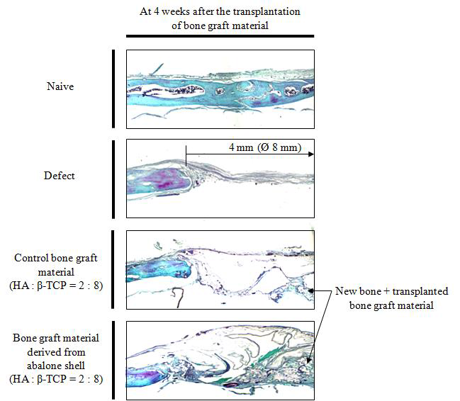 The histological evaluation of defecting area at 4 weeks after the transplantation of synthetic bone grafting materials