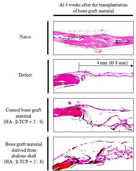 The histological evaluation of defecting area at 4 weeks after the transplantation of synthetic bone grafting materials