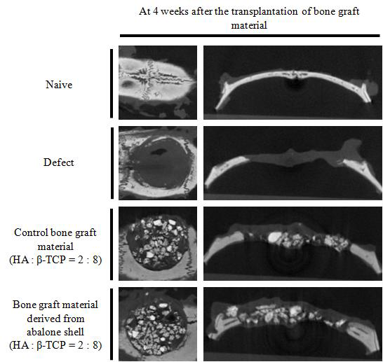 The radiographic evaluation of defecting area at 4 weeks after the transplantation of synthetic bone grafting materials using photography, x-ray and micro-CT image analysis