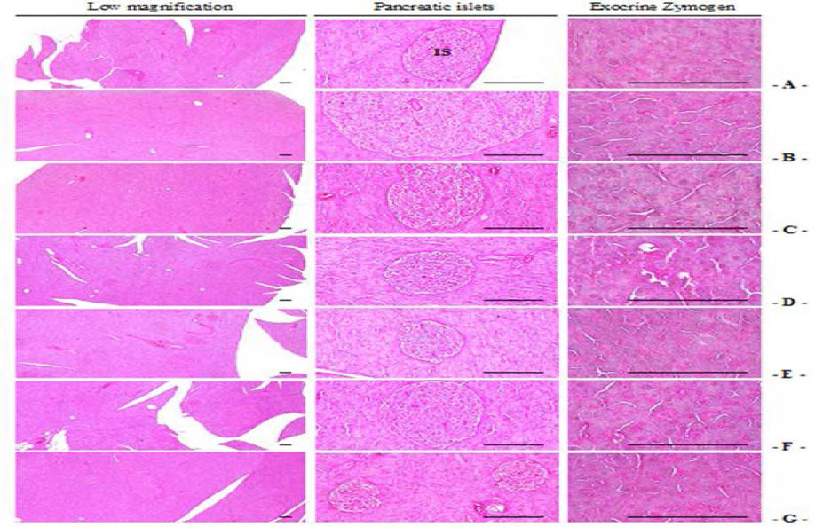 Representative General Histological Images of the Pancreas, Taken from NFD or HFD Supplied Mice