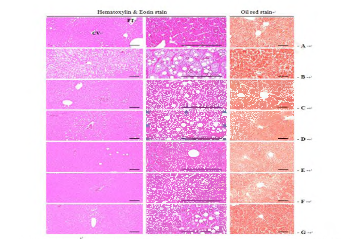 Representative Histological Images of the Liver, Taken from NFD or HFD Supp lied Mice