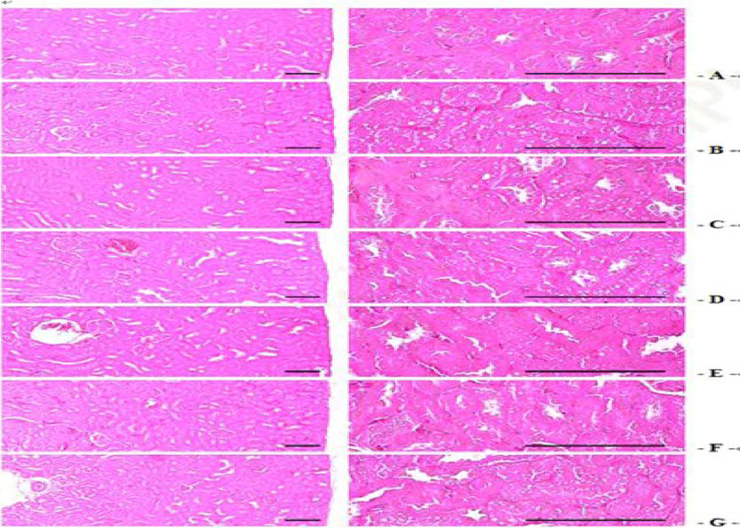 Representative Histological Images of the Kidney, Taken from NFD or HFD Supplied Mice