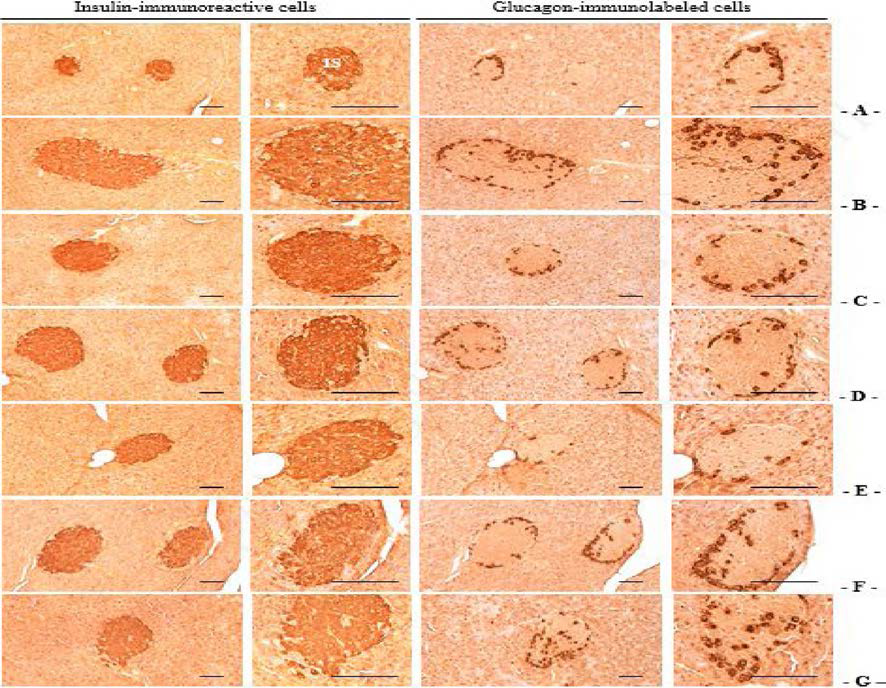 Representative Histological Images of the Insulin- and Glucagon-immunoreactive Cells in the Pancreas, Taken from NFD or HFD Supplied Mice