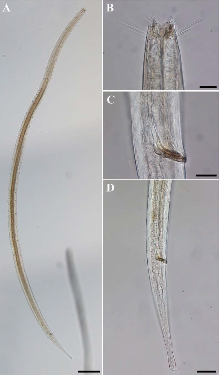 Paramesacanthion n. sp. 1, DIC photomicrographs, male, lateral view