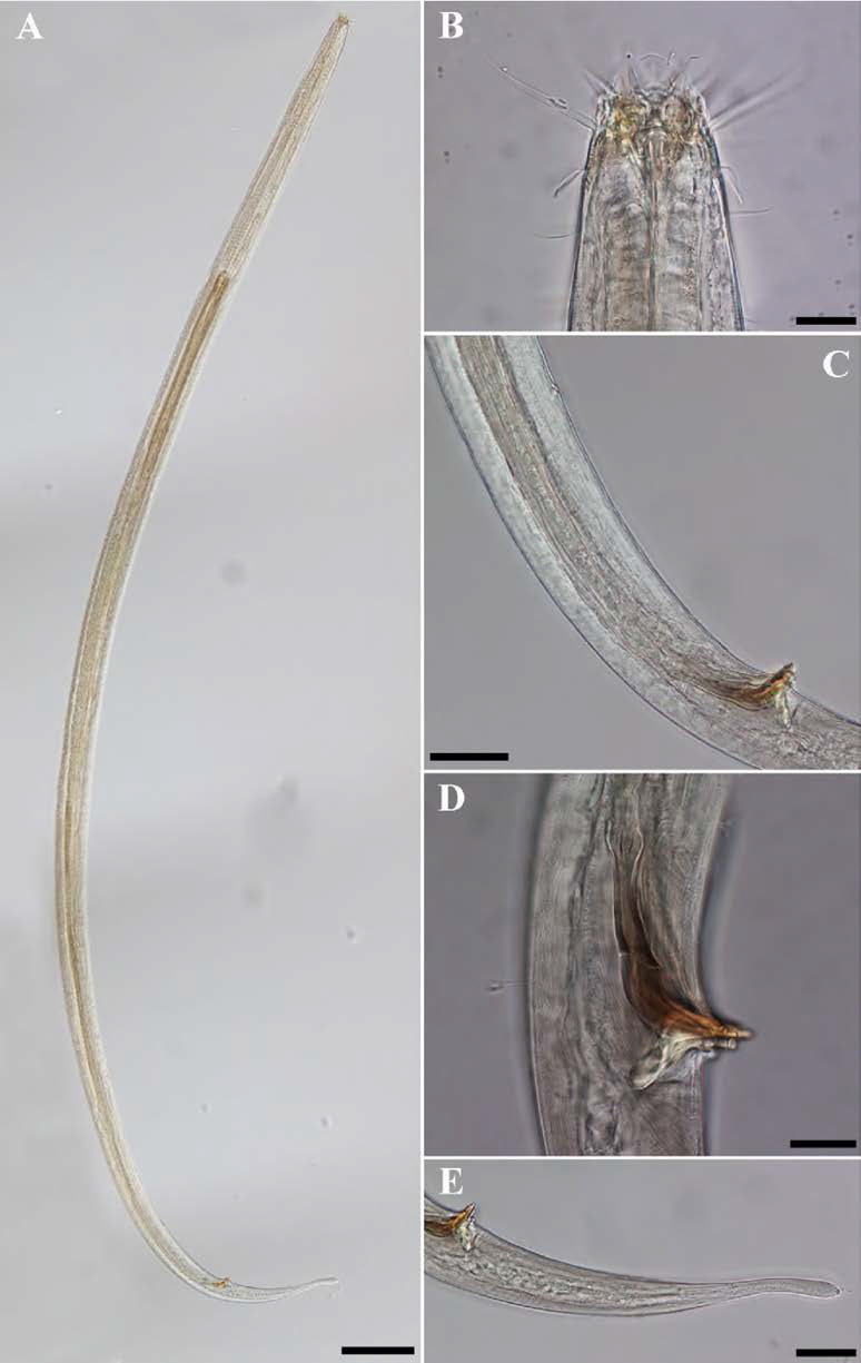 Paramesacanthion n. sp. 2, DIC photomicrographs, male, lateral view