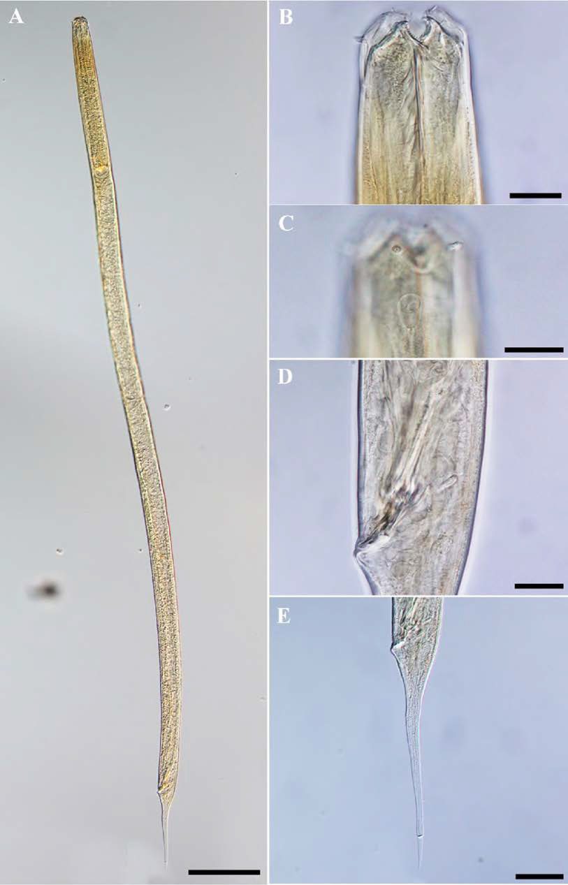 Triodontolaimus acutus, DIC photomicrographs, male, lateral view