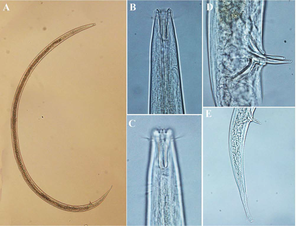 Axonolaimus helgolandicus, DIC photomicrographs, male, lateral view