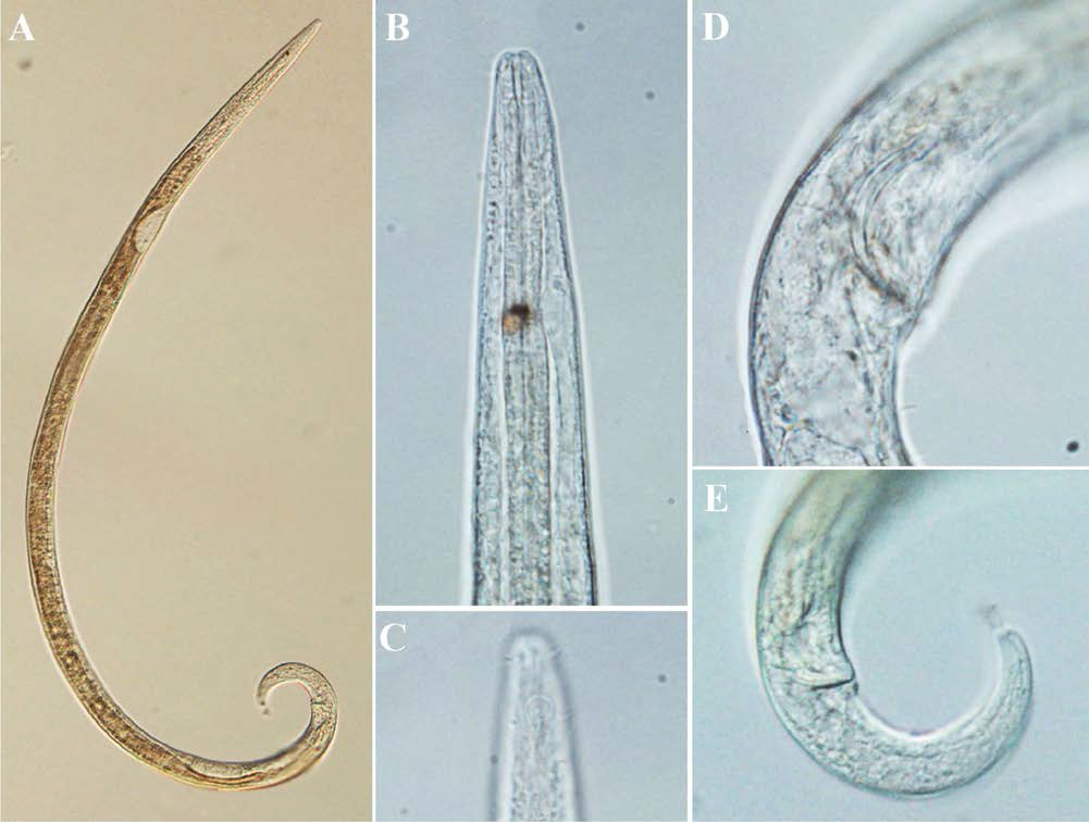 Araeolaimus elegans, DIC photomicrographs, male, lateral view