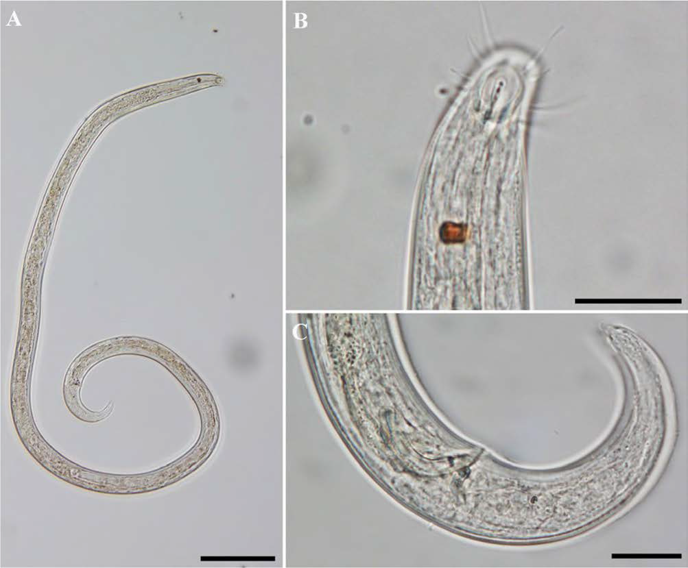 Diplopeltis cirrhatus, DIC photomicrographs, male, lateral view