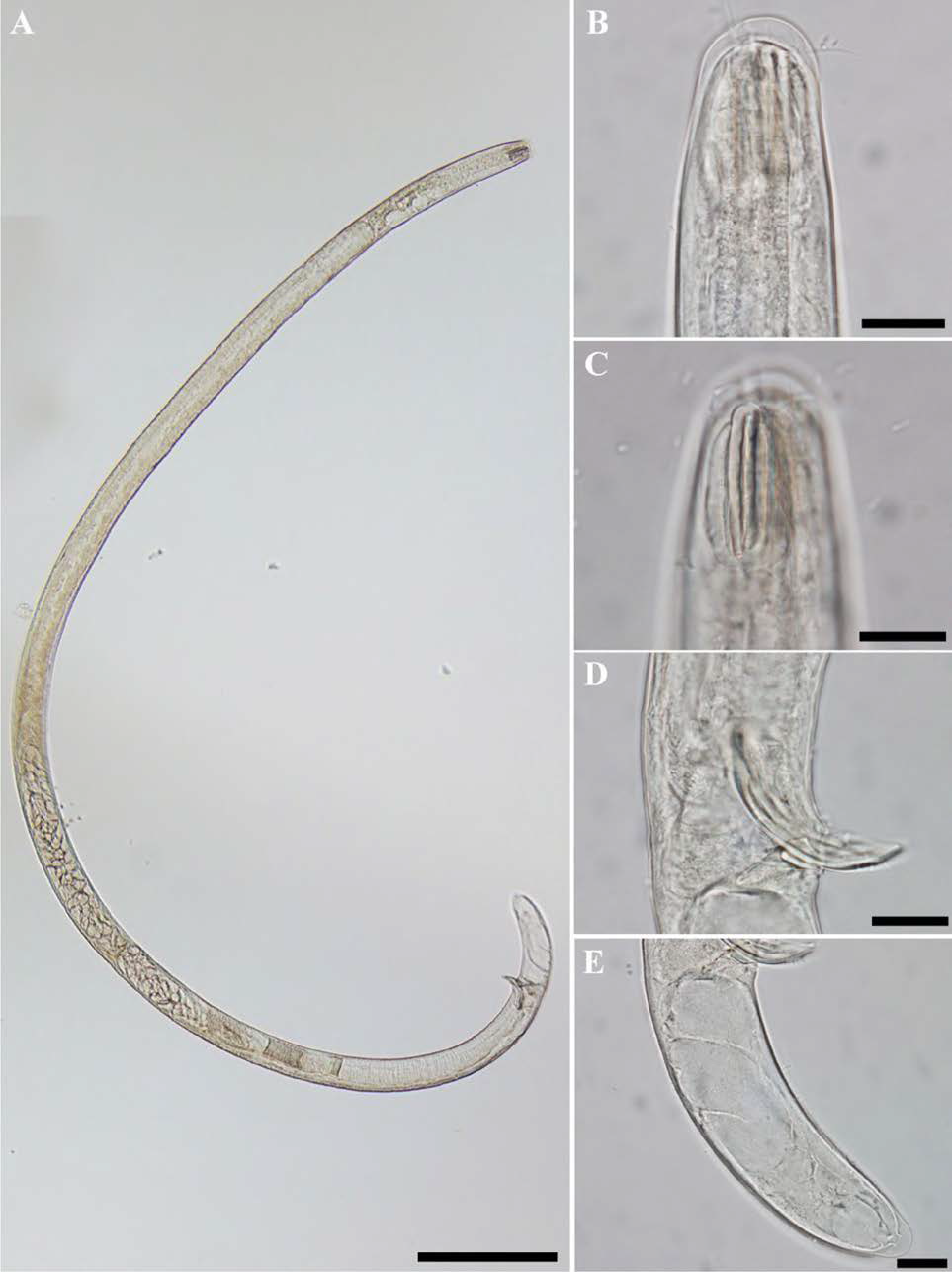 Diplopeltula indica, DIC photomicrographs, male, lateral view
