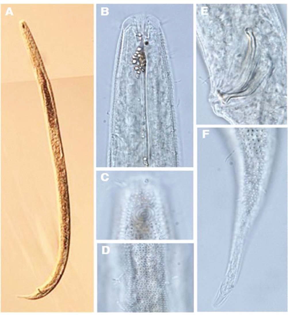 Chromadorella sp., DIC photomicrographs, male, lateral view