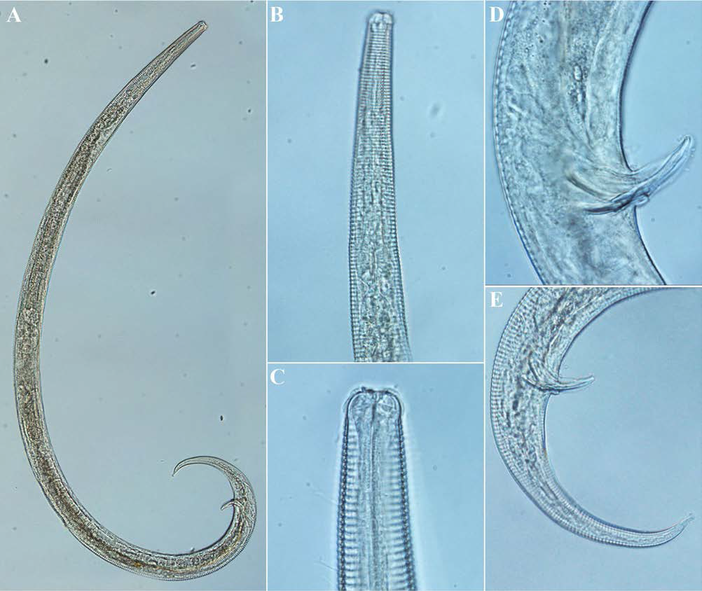 Chromadorita abnormis, DIC photomicrographs, male, lateral view