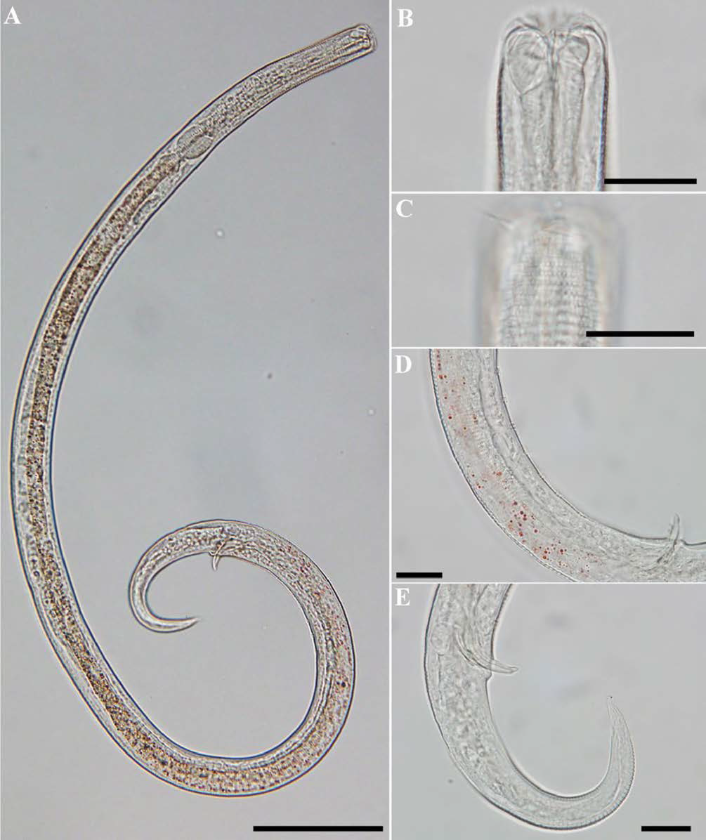 Chromadorita leuckarti, DIC photomicrographs, male, lateral view