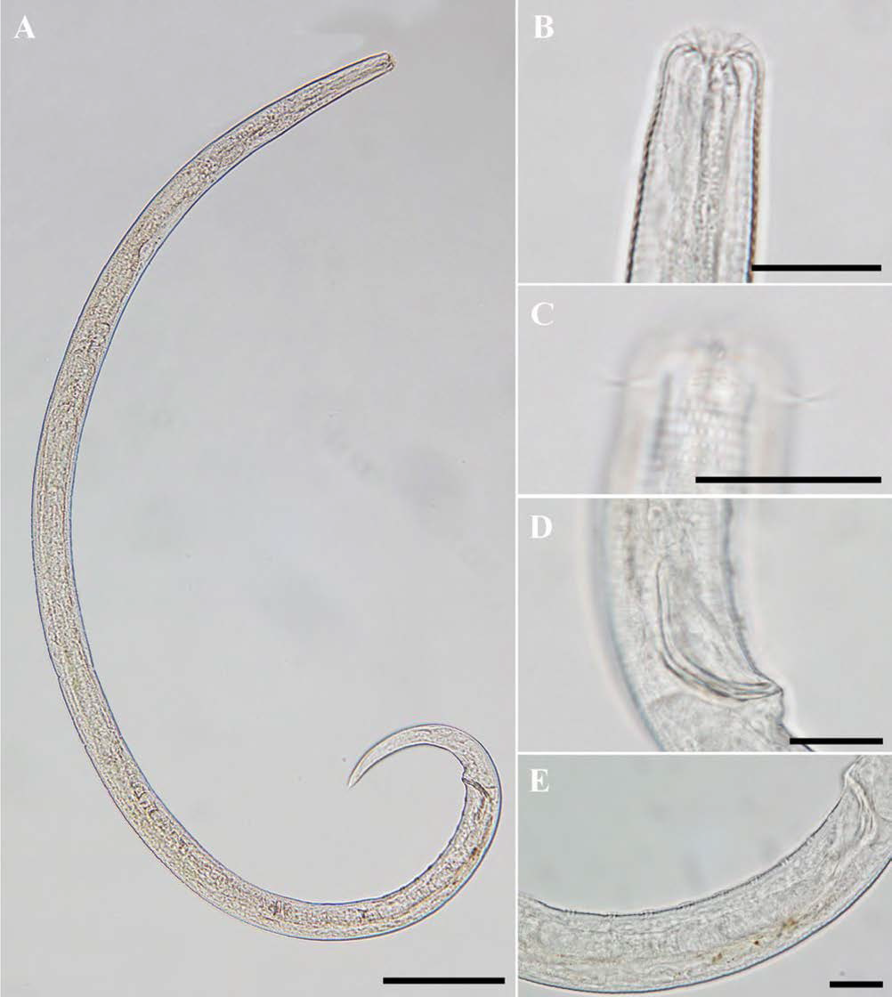 Chromadorita n. sp., DIC photomicrographs, male, lateral view