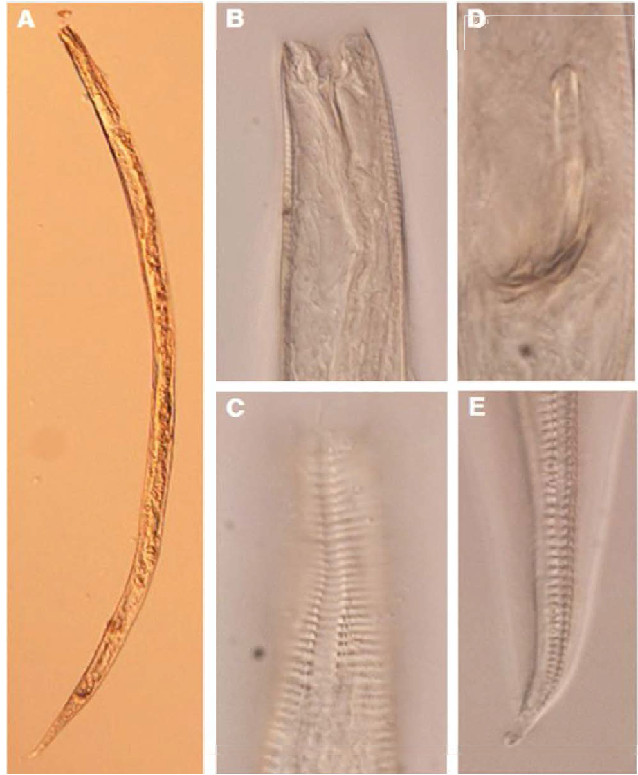 Chromadorita sp. 1, DIC photomicrographs, male, lateral view