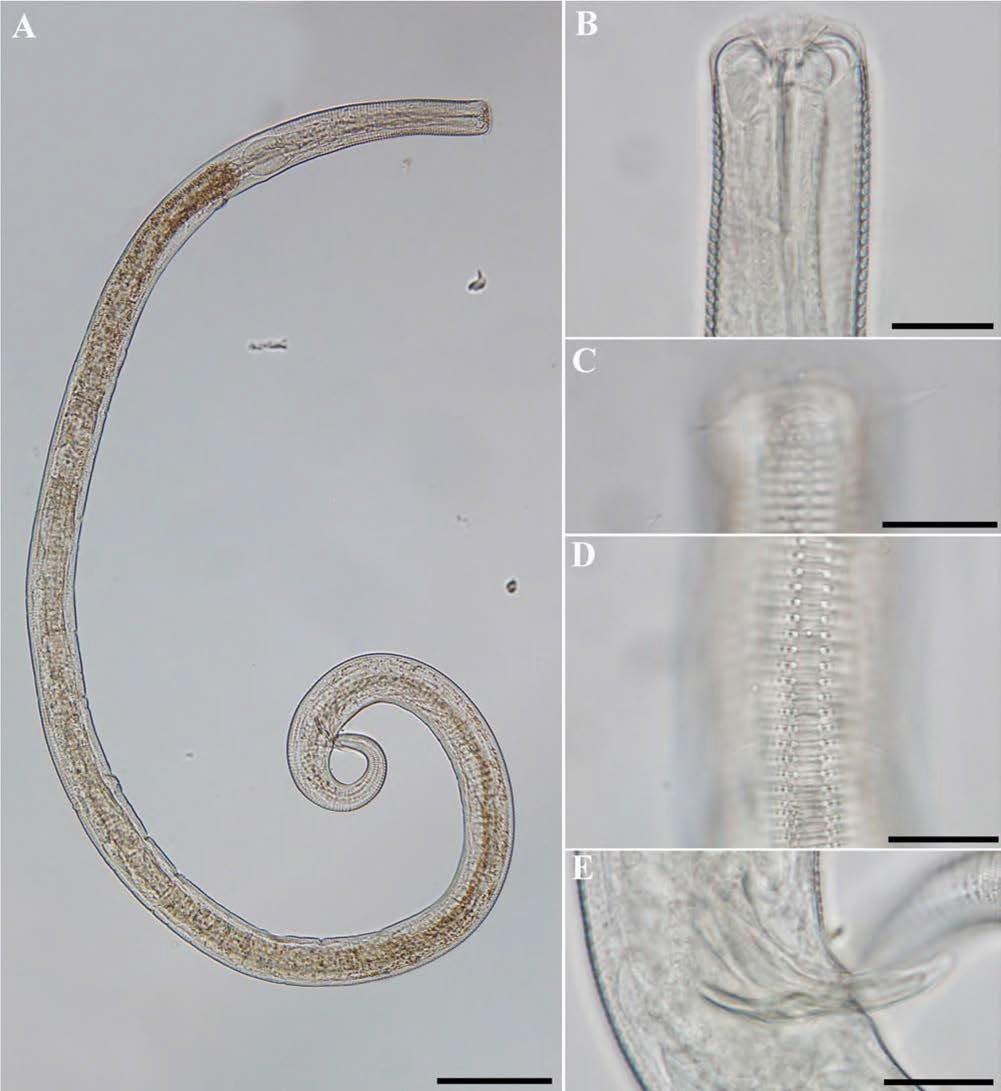 Dichrornadora hyalocheile, DIC photomicrographs, male, lateral view