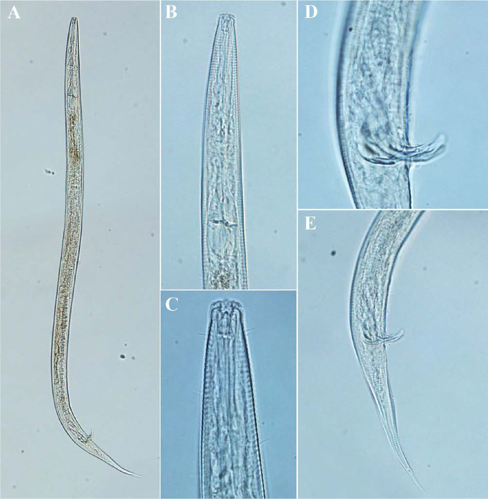Spilophorella euxina, DIC photomicrographs, male, lateral view