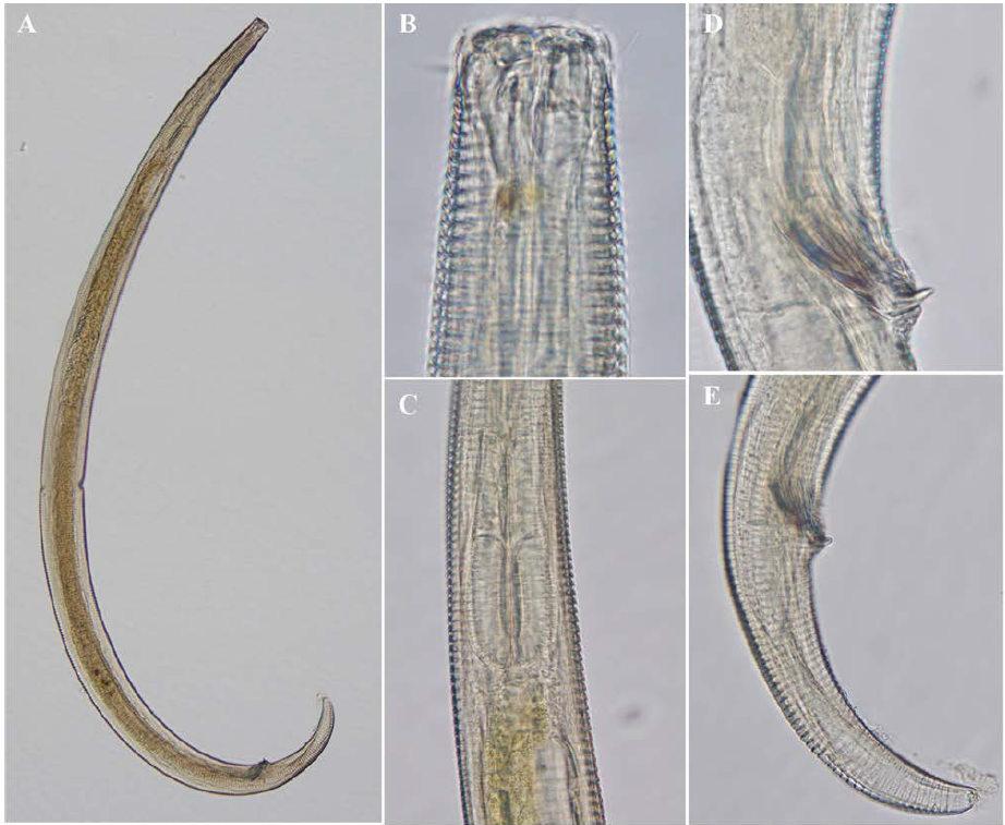 Steirteridora n. sp., DIC photomicrographs, male, lateral view