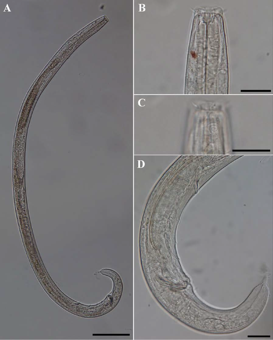 Acanthonchus n. sp., DIC photomicrographs, male, lateral view