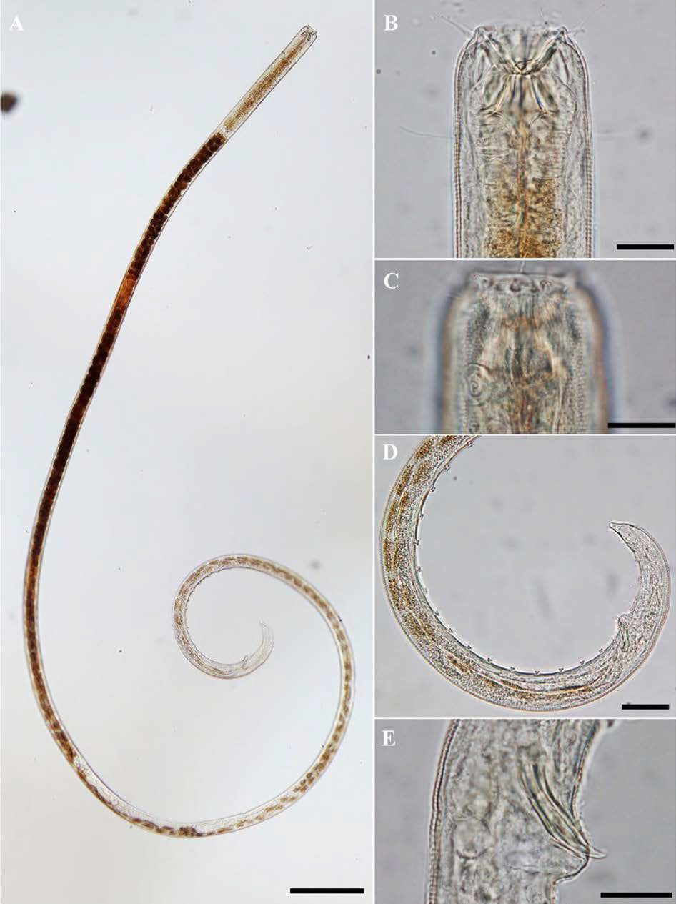 Gammanema n. sp. 2, DIC photomicrographs, male, lateral view