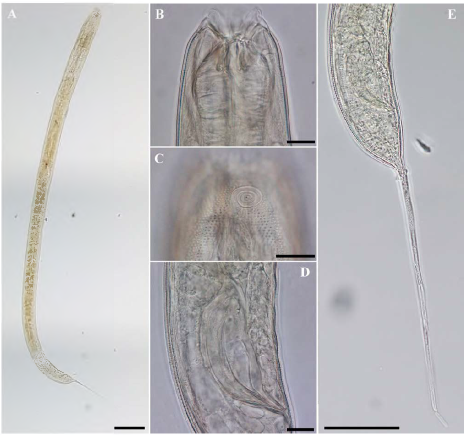 Halichoanolaimus minor, DIC photomicrographs, male, lateral view