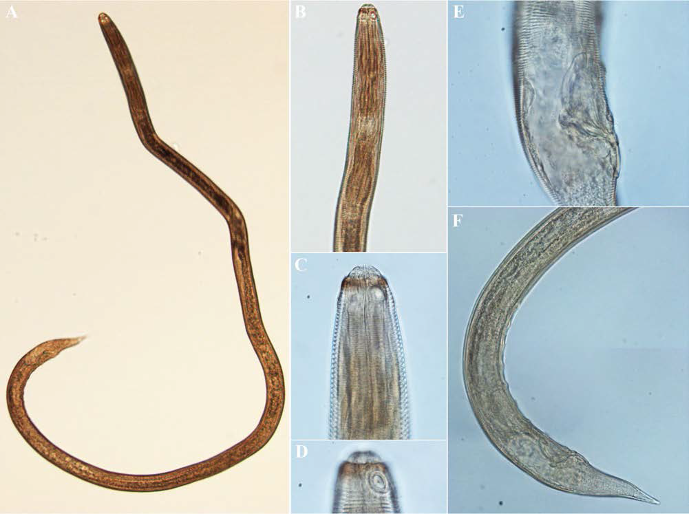 Chromaspirina chabaudi, DIC photomicrographs, male, lateral view