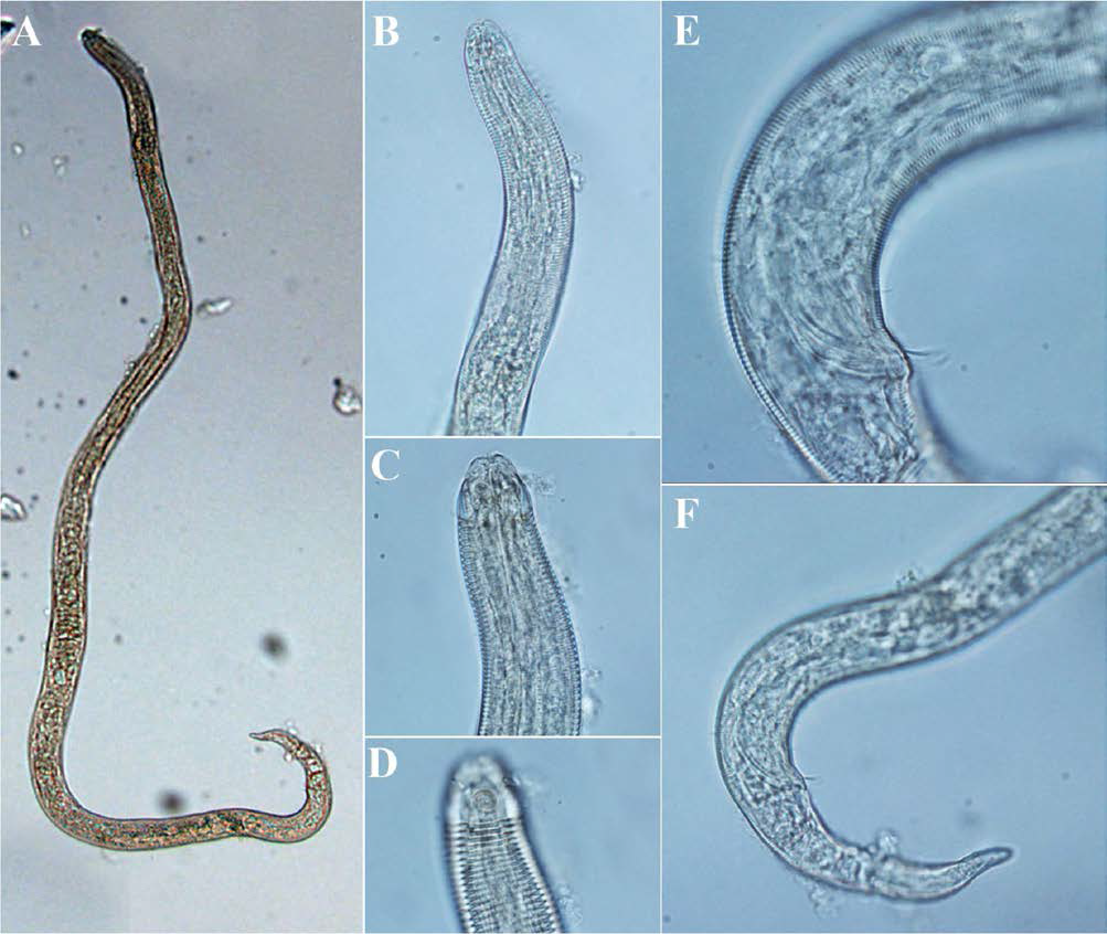 Desmodora granulata, DIC photomicrographs, male, lateral view