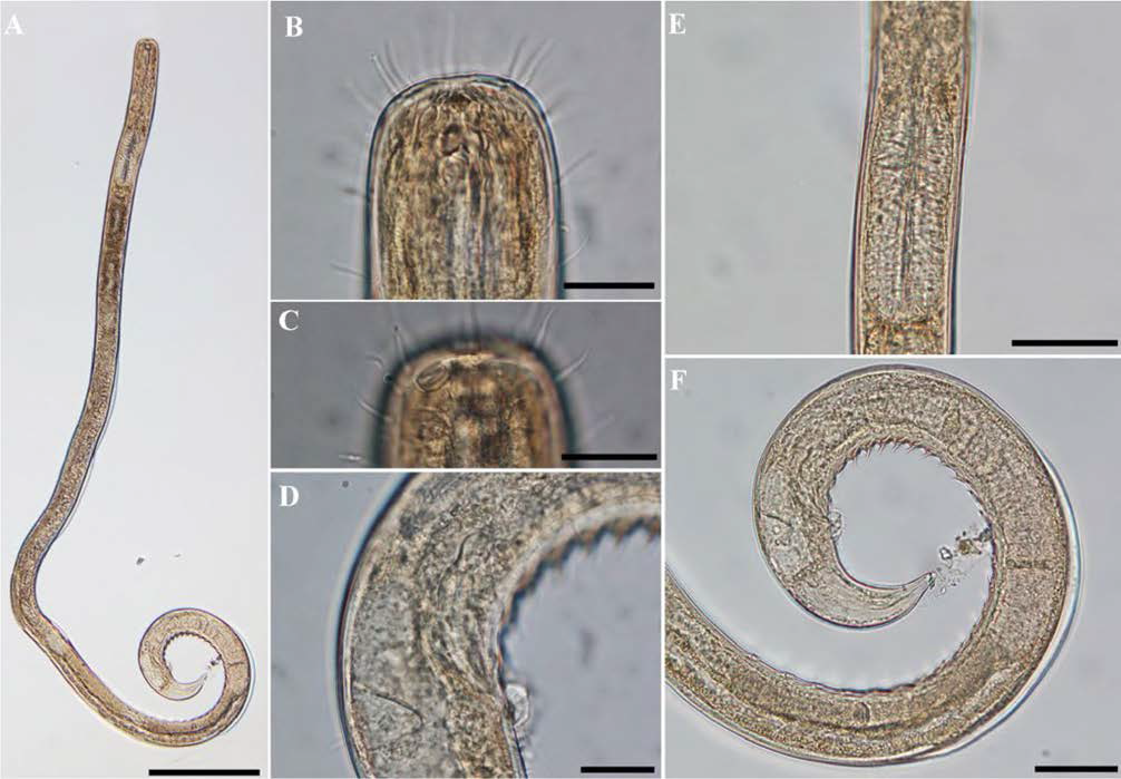 Sigmophoranema n. sp., DIC photomicrographs, male, lateral view