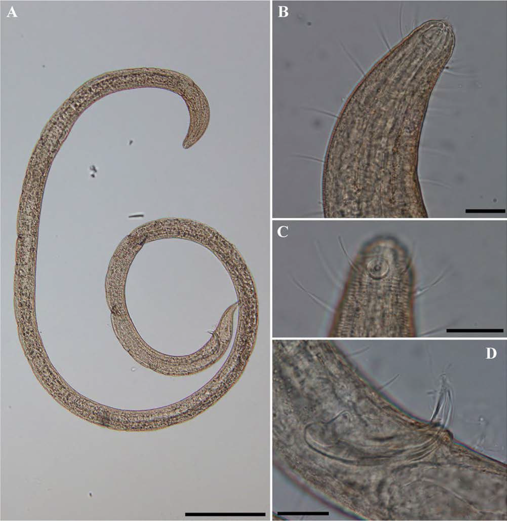 Spirinia n. sp., DIC photomicrographs, male, lateral view