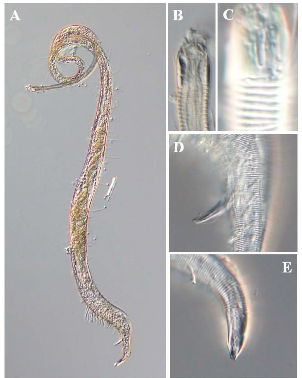 Cygnonema n. sp., DIC photomicrographs, male, lateral view
