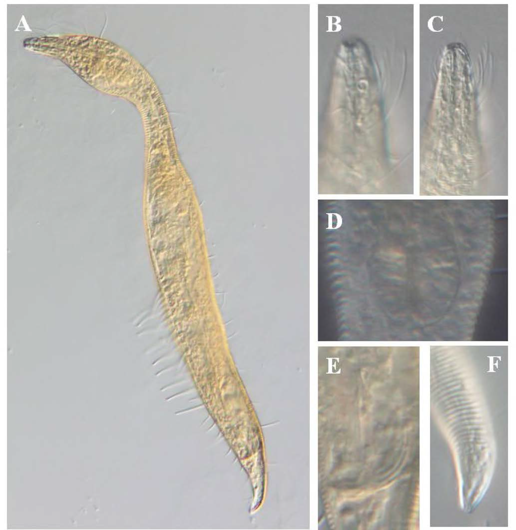 Dinetia orientalis, DIC photomicrographs, male, lateral view