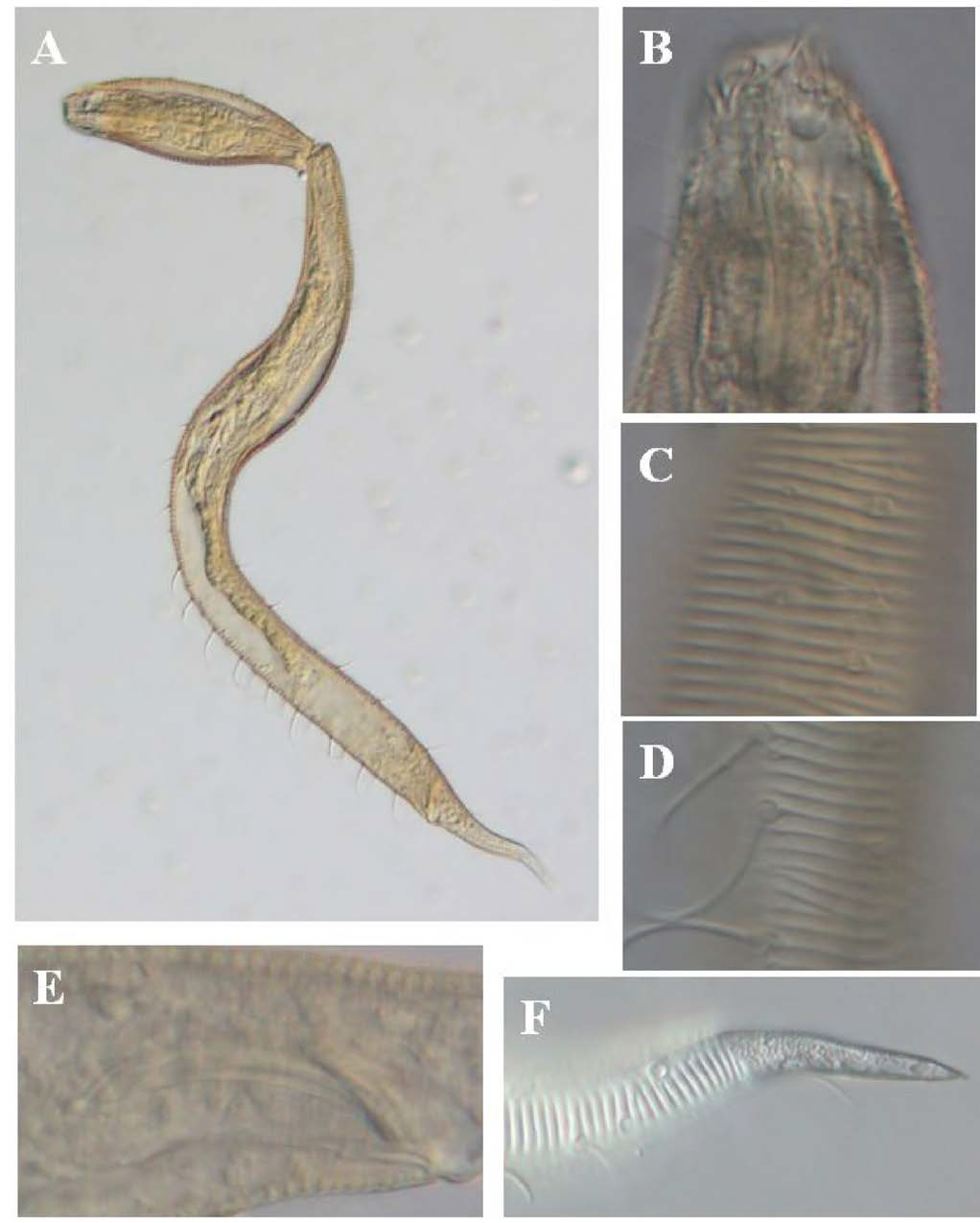 Draco grallus filipjevi, DIC photomicrographs, male, lateral view