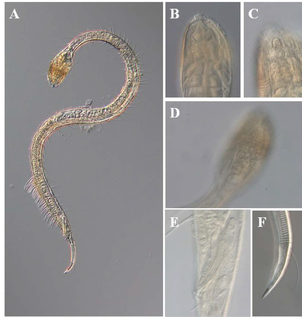 Draconerna youngeouni, DIC photomicrographs, male, lateral view