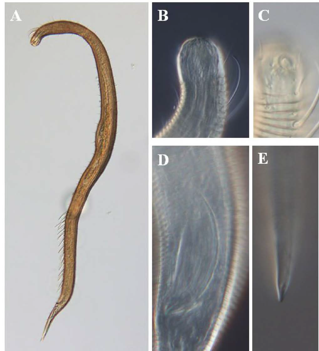 Notochaetosoma namaeense, DIC photomicrographs, male, lateral view