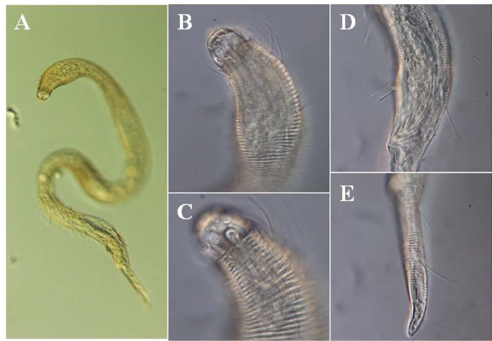 Prochaetosoma beomseomeuse, DIC photomicrographs, male, lateral view