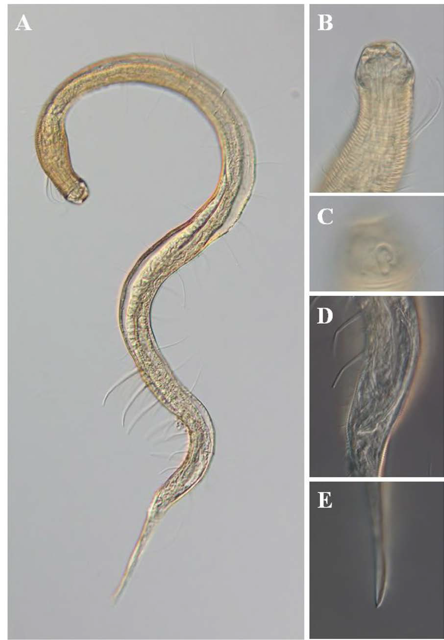 Prochaetosoma dokdoense, DIC photomicrographs, male, lateral view