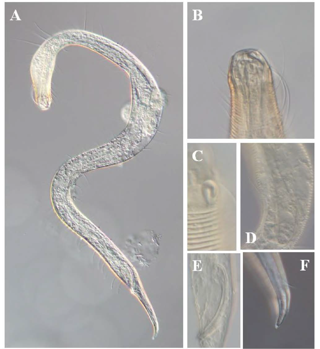 Prochaetosoma n. sp., DIC photomicrographs, male, lateral view