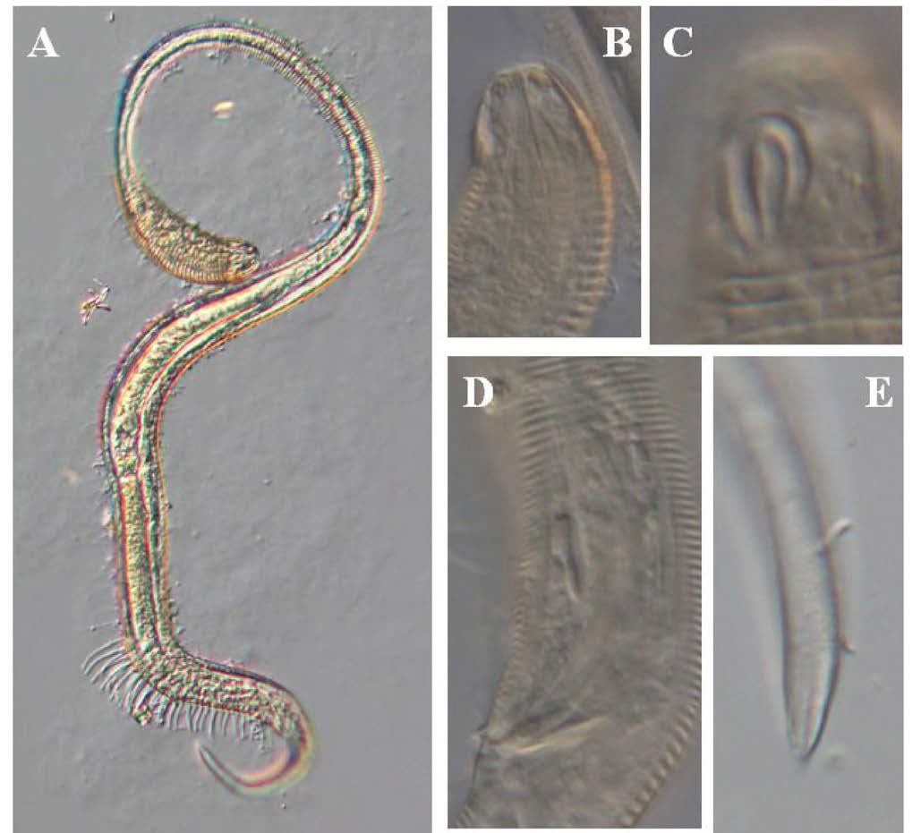 Tenuidraconema koreense, DIC photomicrographs, male, lateral view