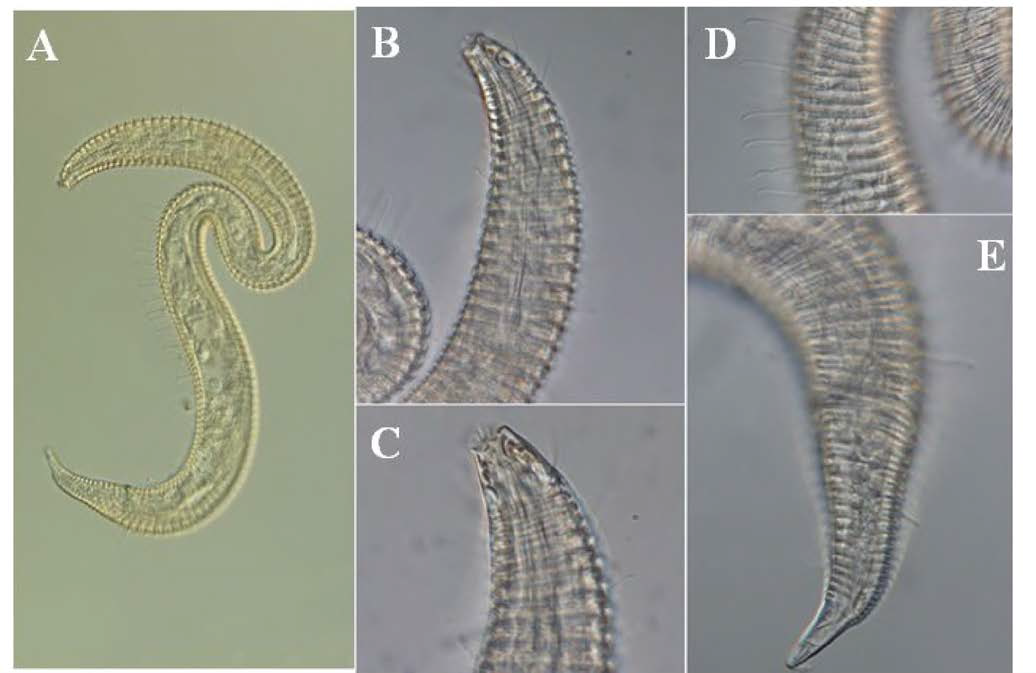 Leptepsilonema n. sp. 2, DIC photomicrographs, male, lateral view