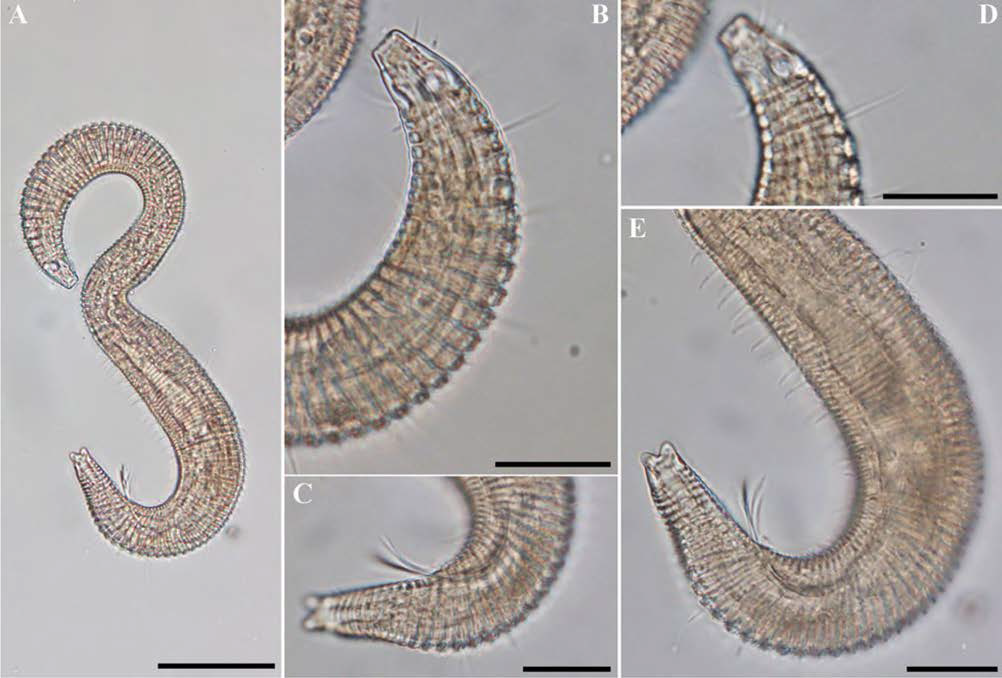Triepsilonema n. sp., DIC photomicrographs, male, lateral view