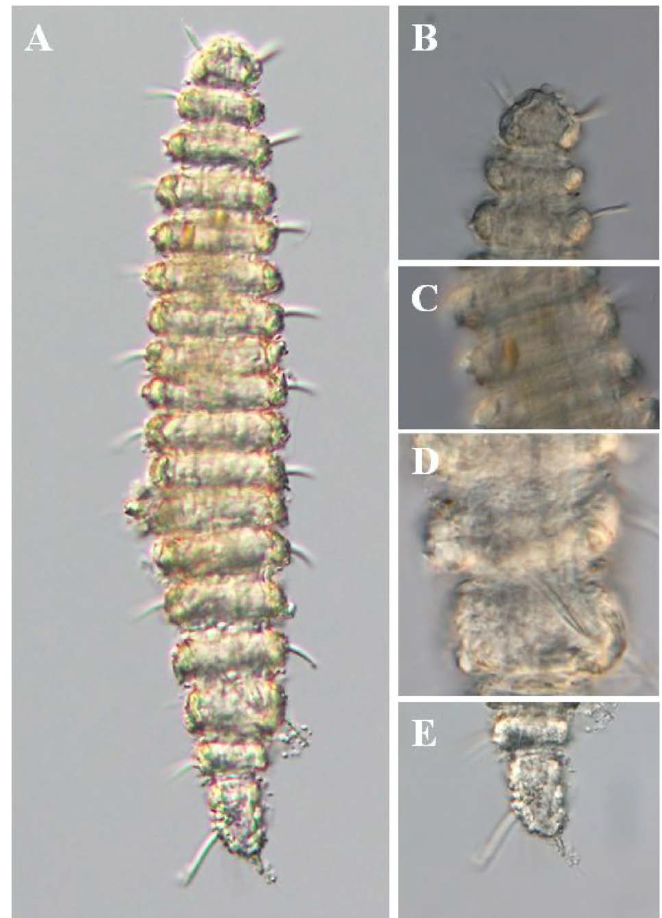 Desmoscolex n. sp. 3, DIC photomicrographs, male, lateral view