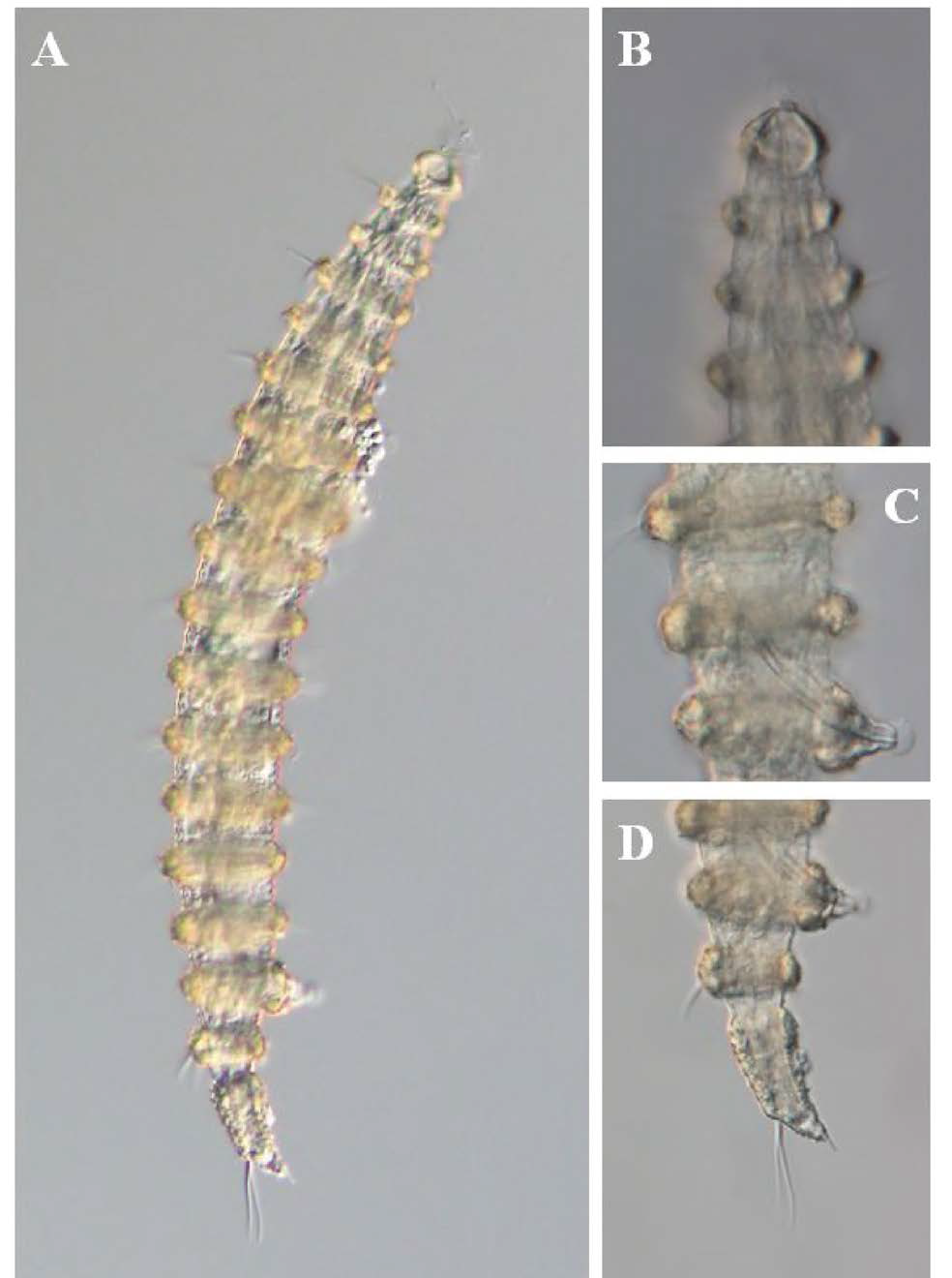 Desmoscolex n. sp. 4, DIC photomicrographs, male, lateral view