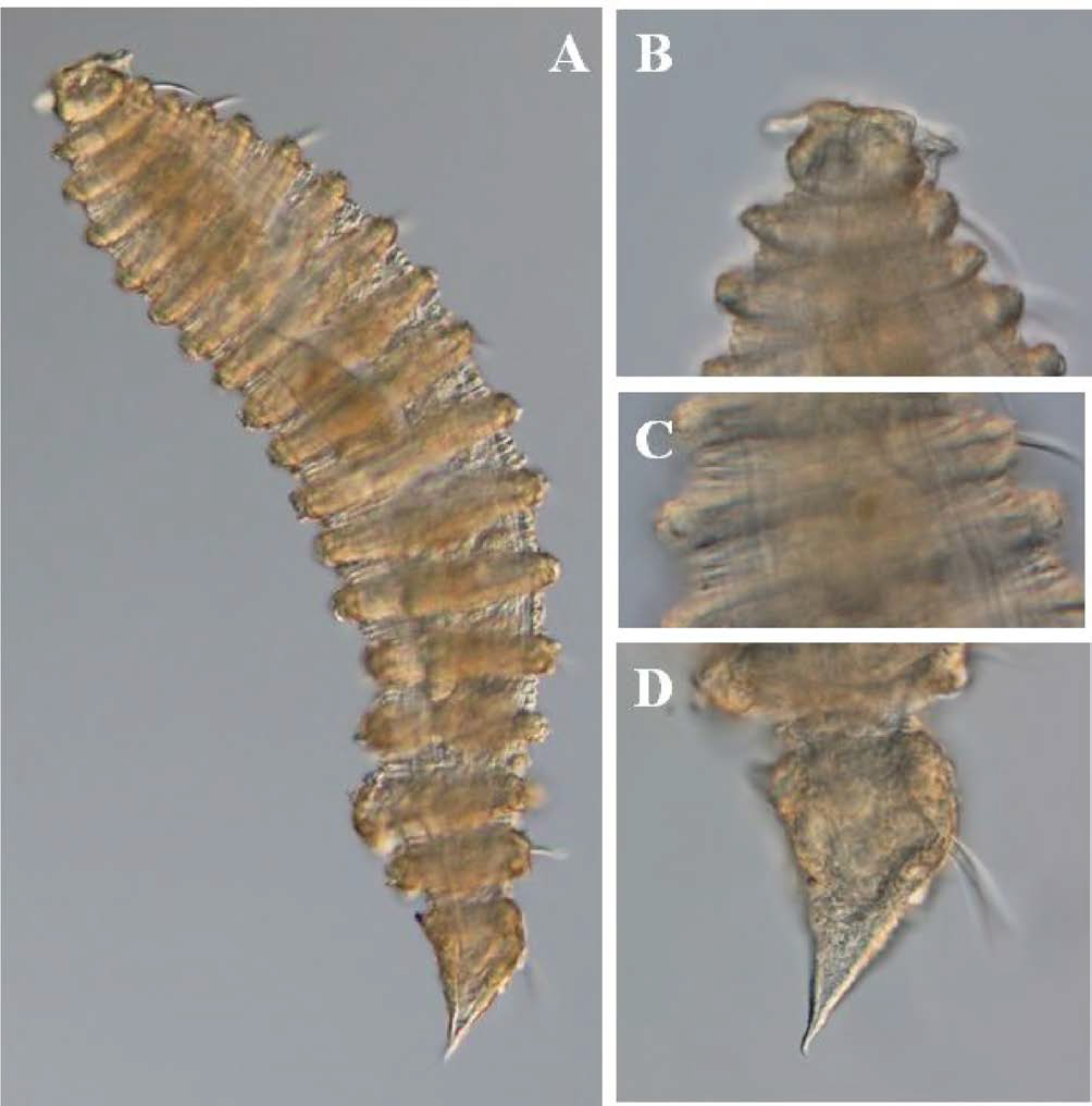 Desmoscolex n. sp. 5, DIC photomicrographs, female, lateral view