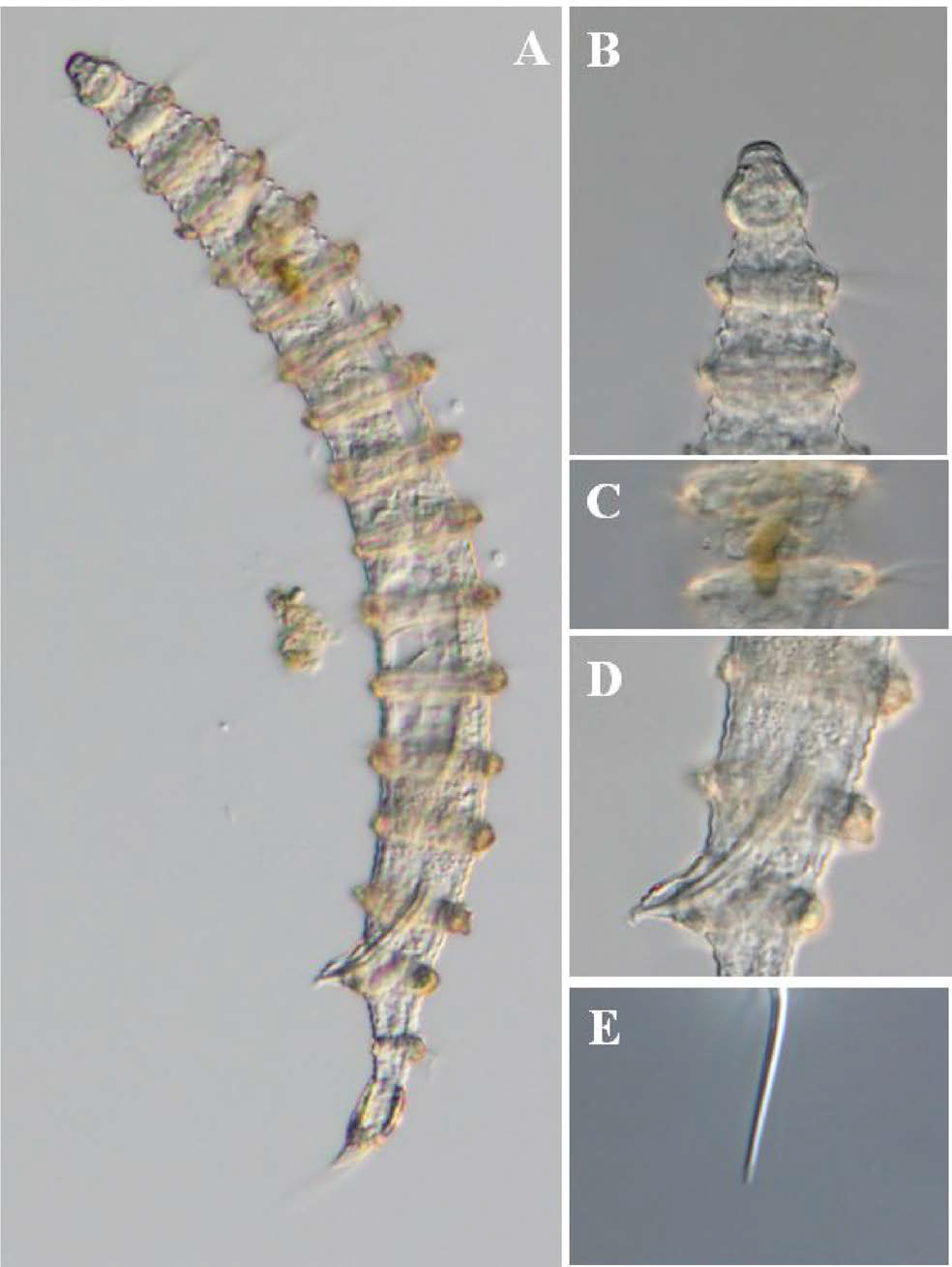 Desmoscolex n. sp. 6, DIC photomicrographs, male, lateral view