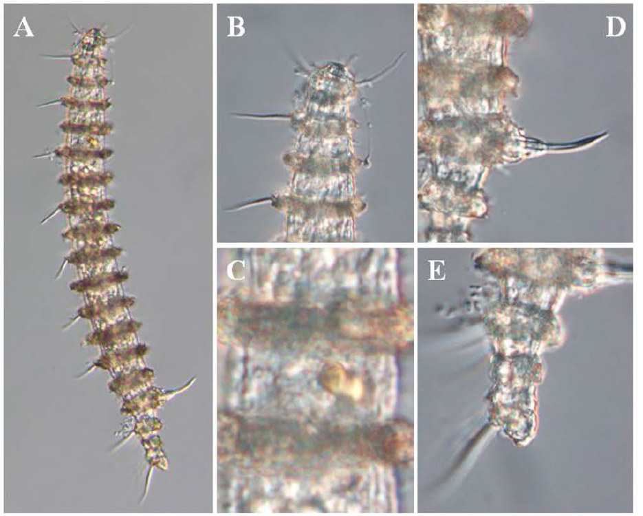 Desmoscolex n. sp. 7, DIC photomicrographs, male, lateral view