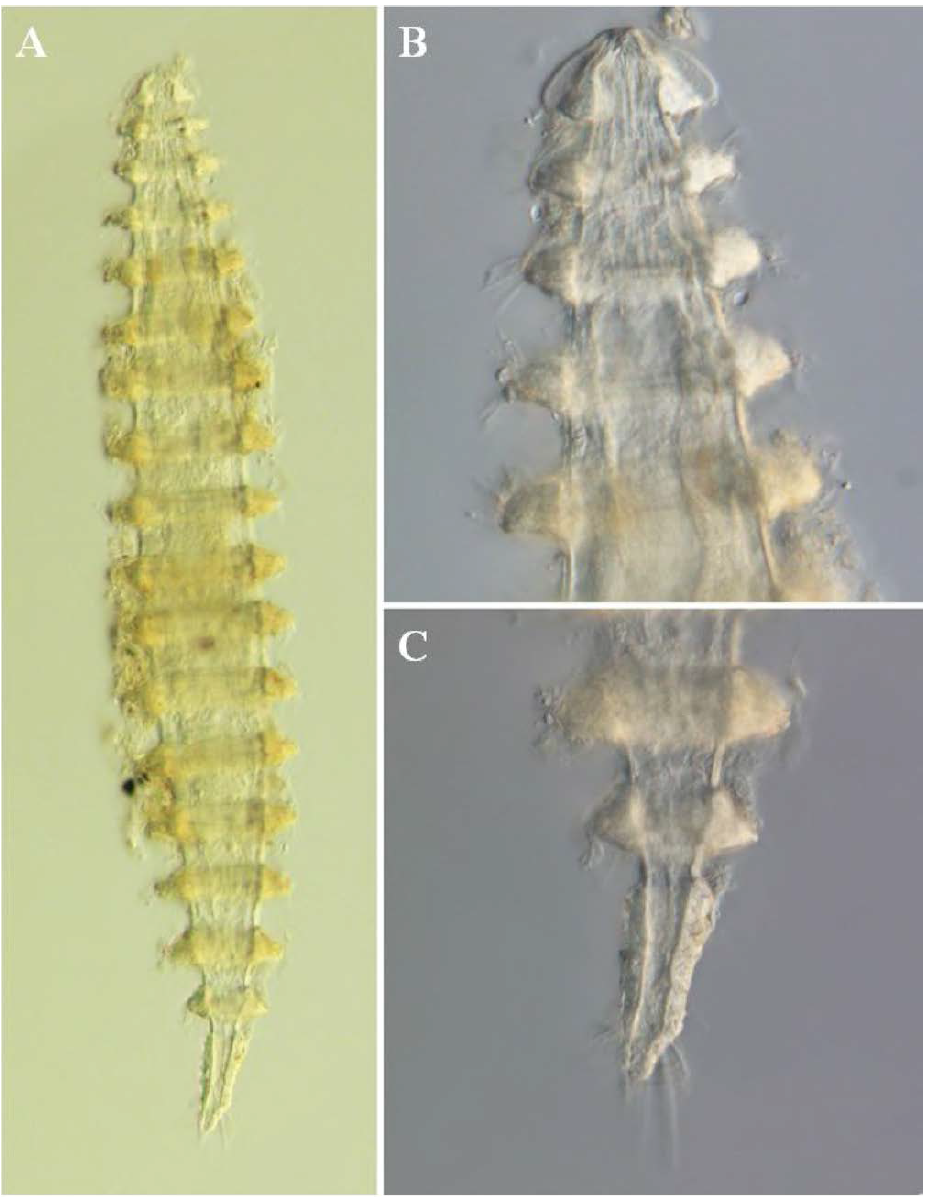 Desmoscolex n. sp. 9, DIC photomicrographs, female, lateral view