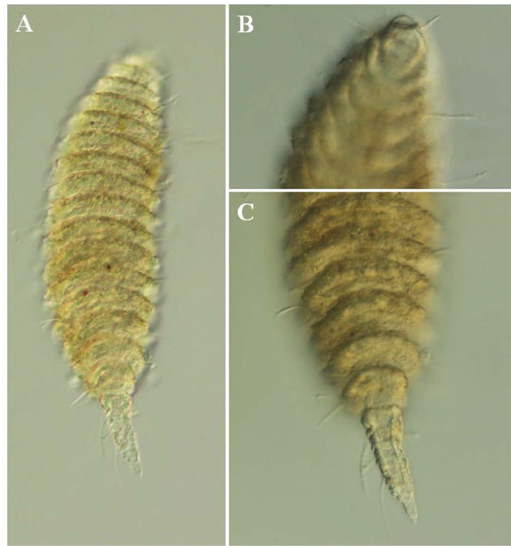 Desmoscolex n. sp. 11, DIC photomicrographs, female