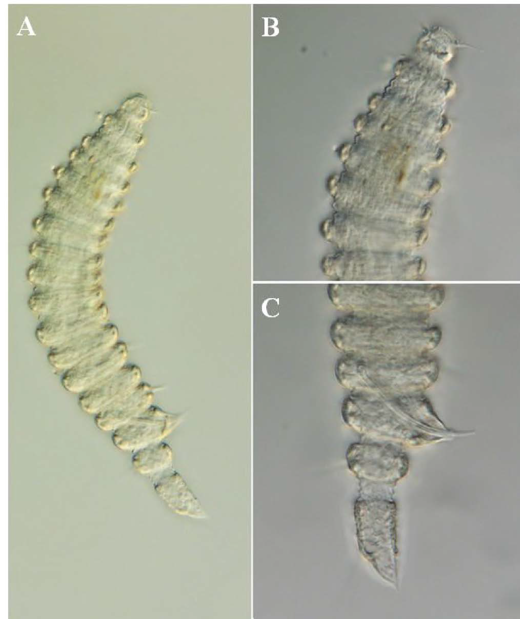 Desmoscolex n. sp. 12, DIC photomicrographs, male, lateral view